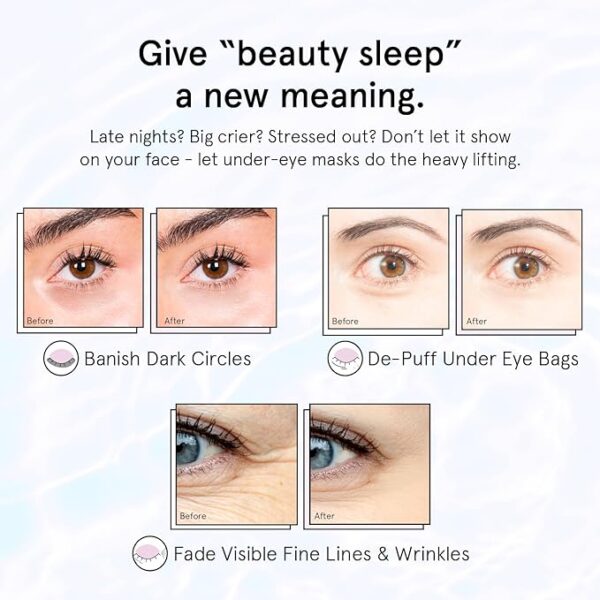 grace & stella Under Eye Patches for Puffy Eyes and Dark Circles (Retinol, 24 Pairs) Restoring Gel Under Eye Masks with Hyaluronic Acid - Vegan Cruelty-Free Skincare Birthday Gifts for Women - Image 3