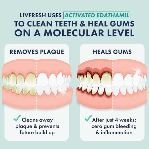 Toothpaste Gel, Clinically Proven to Remove Plaque 250% Better, Improves Gum Health 190% Better, Prevents & Reduces Tartar, Freshens Breath, SLS Free Dental Gel, Wintergreen - Image 5