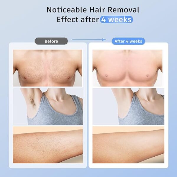 Laser Hair Removal with 5℃ Ice Cooling, Painless IPL Laser Hair Removal Device 3 In 1 Ubroo At Home Hair Remover Machine for Women Men Electrolysis Permanent Epilator on Face Body Depilation (Gold) - Image 2