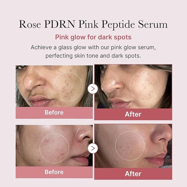 medicube PDRN Pink Peptide Serum, Pink glow serum, 1.01 fl.oz. | Peptide, Niacinamide, Hydrating & Moisturizing & Firming, Uneven Skin Tone - Image 6