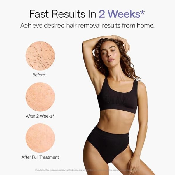 Ulike Laser Hair Removal, Air 10 IPL Hair Removal for Women and Men, 65°F Ice-Cooling Contact, Dual Lights, Skin Sensor & SHR Mode* for Nearly Painless, Effective & Long-Lasting Hair Removal from Home - Image 2