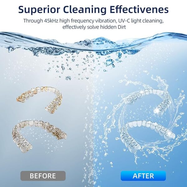 Ultrasonic Retainer Cleaner, Retainer Cleaner Machine for Dentures, Mouth Guards, Braces, Toothbrush Heads, Jewelry with 200ML Capacity, 45kHz Retainer Cleaning, 4 Modes for All Dental Appliances - Image 3
