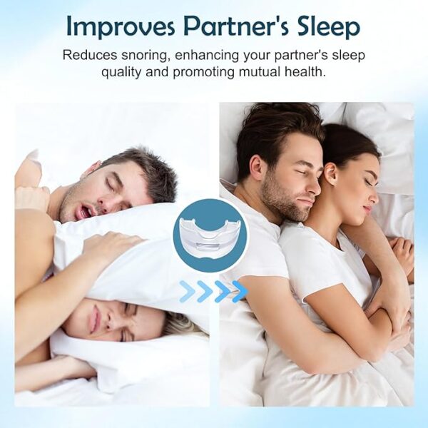 Anti Snoring Mouthpiece - Anti SnoringMouthpiece Device Mouth Guard,Snore Reduction Device for Men and Women, Comfortable Mouth Guard for Better Sleep, 1 Pack (Blue)-ZHA5 - Image 3