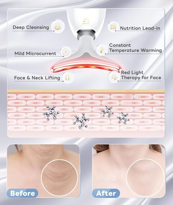 Light Based Multifunctional Facial Massager, 7 Color Portable Face Massager Tool for Skin Care, Glossy White - Image 5