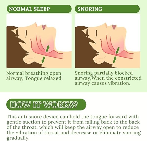 Anti-Snoring Devices, Comfortable Snoring Solution, Effective Snore Devices Stopper for Men and Women - Z4 - Image 5