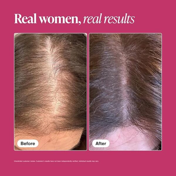Viviscal Hair Growth Supplements For Women For Thicker, Fuller Hair, Nourishes Thinning & Loss, With Proprietary Collagen Complex, 180 Tablets, 3 Month Supply - Image 5